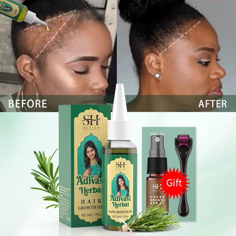 Ayurvedic Hair Growth Oil Indi - Ayurvedic & Herbal Wellness Kits review and price