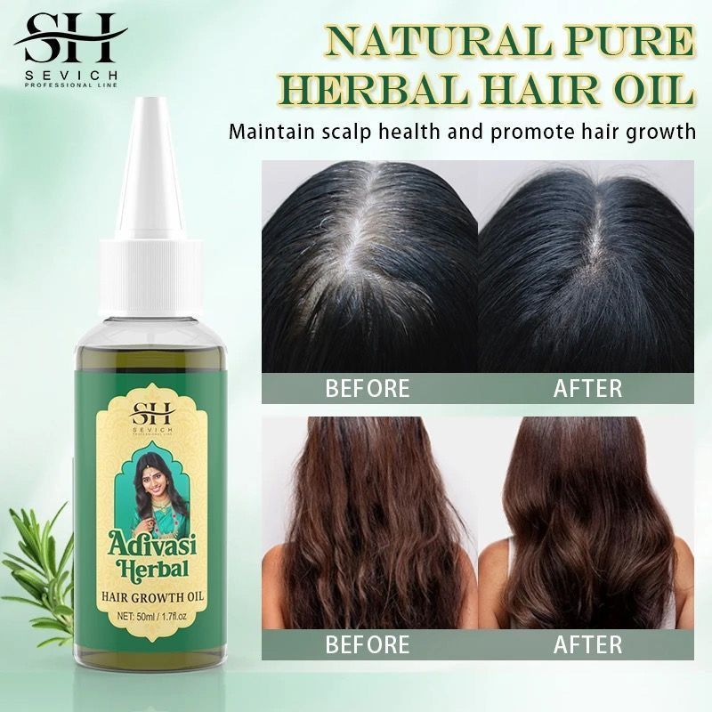 Ayurvedic Hair Growth Oil Indi - Ayurvedic & Herbal Wellness Kits review and price