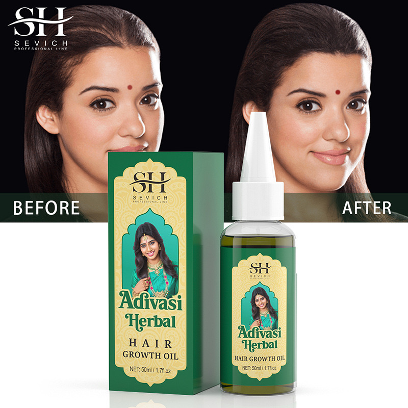 50ml Original India Oil Adivas - Ayurvedic & Herbal Wellness Kits review and price